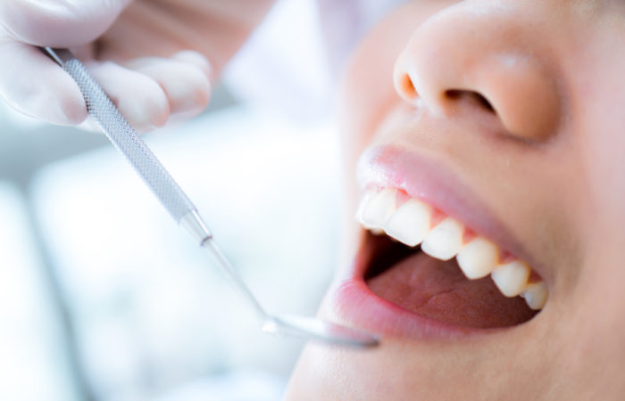 בדיקת שיניים תקופתית