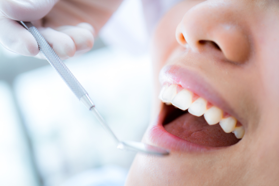 בדיקת שיניים תקופתית
